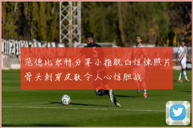 范德比尔特分享小指脱臼惊悚照片骨头刺穿皮肤令人心惊胆战